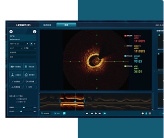 恒宇醫(yī)療OCT系統(tǒng)醫(yī)療影像軟件界面設計